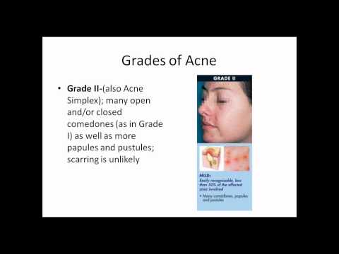 Definitions and Causes of Acne