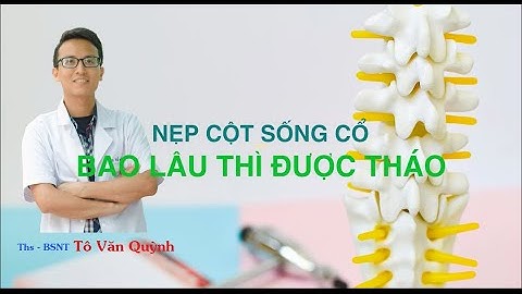 SAU MỔ CỘT SỐNG CỔ, NẸP CỔ ĐEO BAO LÂU THÌ BỎ ĐƯỢC