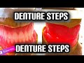 Denture steps bite blocks and bite registration