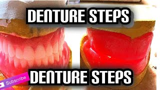 Denture Steps (Bite Blocks and Bite Registration)