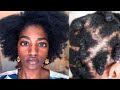 FINE. NATURAL. HAIR. | The Realities of Fine 4C Natural Hair