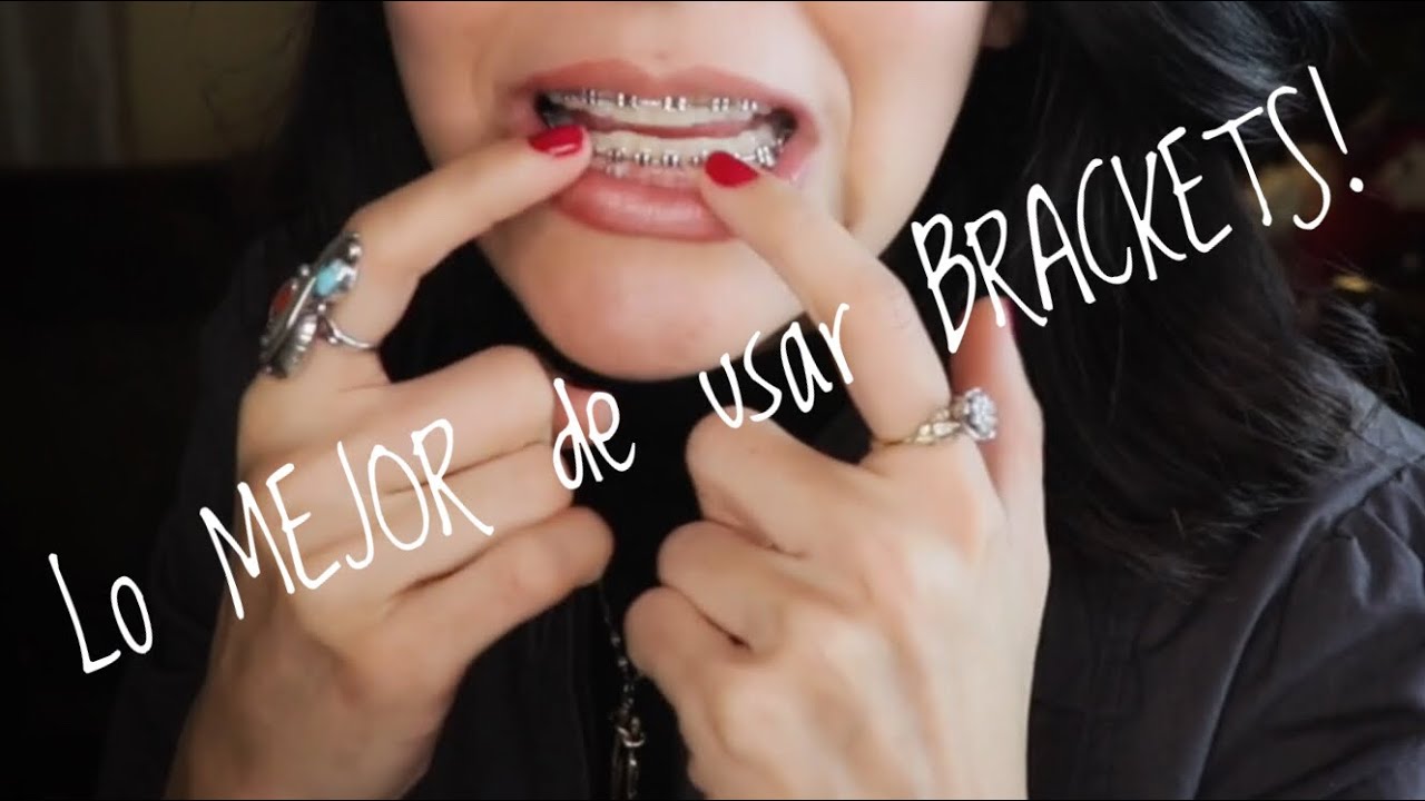 Lo BUENO de usar BRACKETS! (Frenos) ligas del real madrid