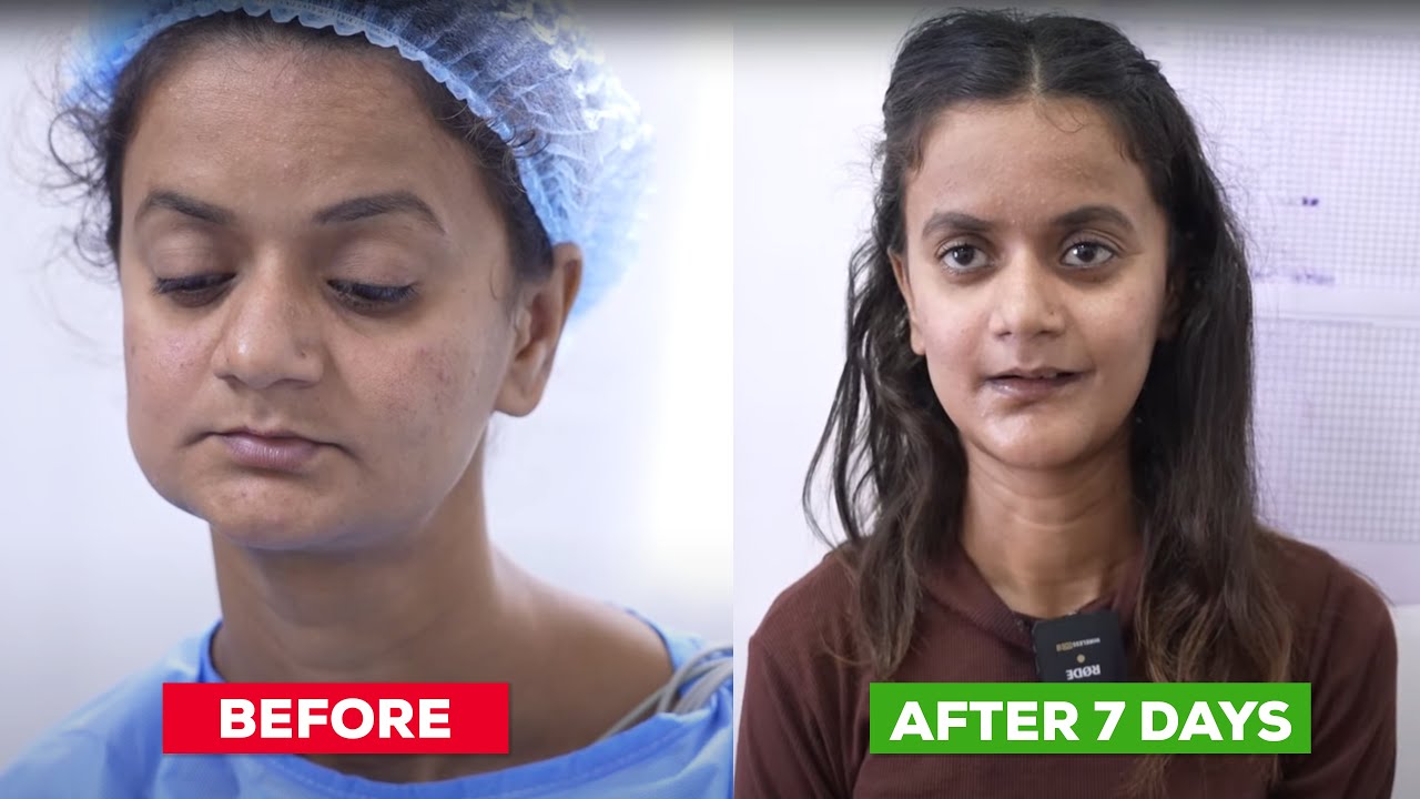 JawDropping Transformation Unbelievable Face Surgery Revealed! 😱