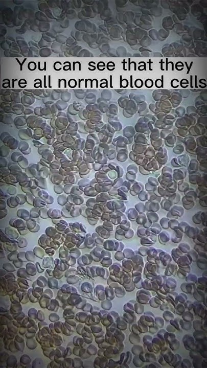 are-there-toxins-in-menstrual-blood-youtube