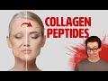 Reversing skin aging with collagen peptides 11 studies later