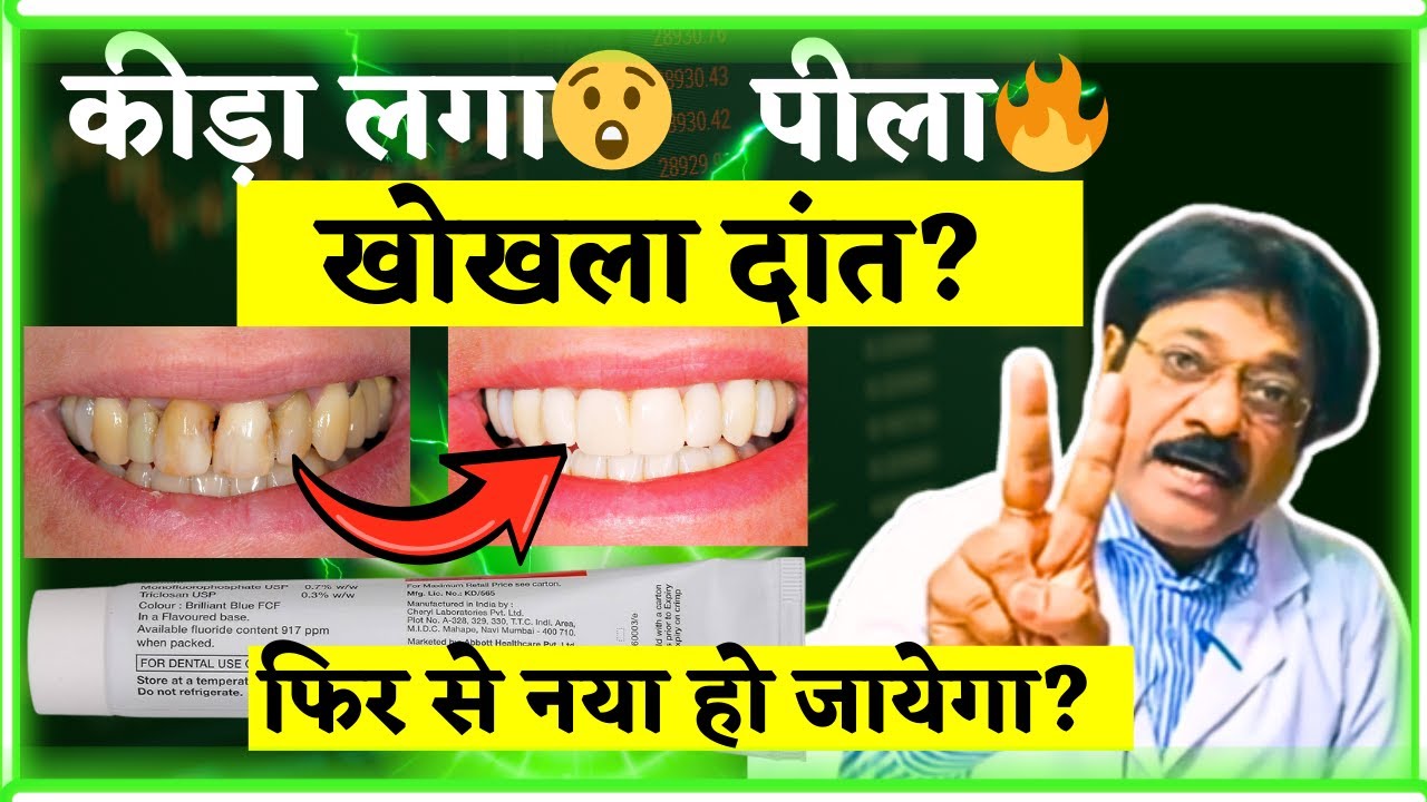 ब्रश करो या मत करो साल में 1 बार इससे धो लो दाँत नया हो जायेगा🪕| Toothpaste For All Teeth Problems😃