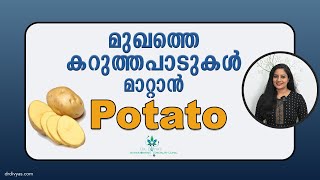 മുഖത്തെ കറുത്ത പാടുകൾ മാറ്റാൻ Potato FacePack | Remove Dark Spots, Hyperpigmentation, Skin Whitening