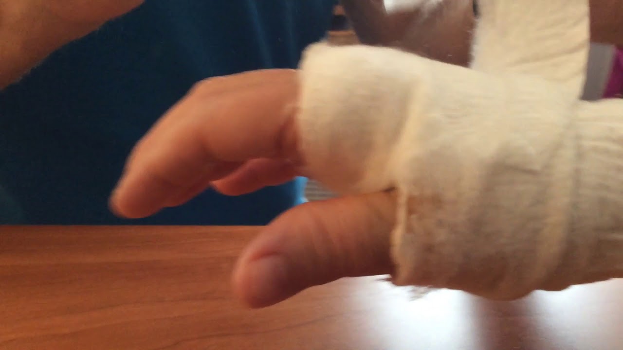 Carpal Tunnel Surgery Bandage Removal 4 Days Post Op YouTube carpal-tunnel-surgery-bandage-removal-4-days-post-op-youtube