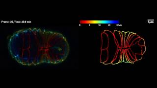 Tracking Epithelial Cell Junctions in C. elegans Embryogenesis