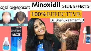 Minoxidil Side Effects Hairloss Treatment Mintop Malayalam