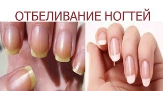 ОТБЕЛИВАНИЕ НОГТЕЙ nail care в домашних условиях(, 2014-06-06T05:00:01.000Z)