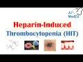 Heparin-Induced Thrombocytopenia (HIT) | Types, Signs & Symptoms, Diagnosis, Treatment