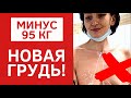 СЛОЖНАЯ ПОДТЯЖКА ГРУДИ С ИМПЛАНТАМИ | ОТКРОВЕННО ИЗ ОПЕРАЦИОННОЙ |  МАММОПЛАСТИКА ПОСЛЕ ПОХУДЕНИЯ