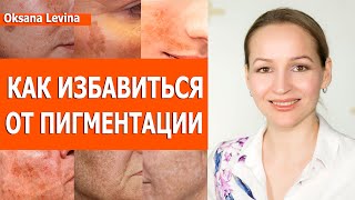 Лучшие процедуры от пигментации. Веснушки, мелазма, старческие пятна. Лечим пигментацию правильно