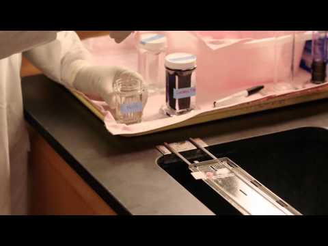 Vídeo: Uso De PCR Multiplex En Tiempo Real, Prueba De Diagnóstico Rápido De Malaria Y Microscopía Para Investigar La Prevalencia De Especies De Plasmodium Entre Pacientes Hospitalizados C