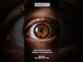 ਨਜ਼ਰ ਬਚਾਉਣ ਲਈ ਸਮੇਂ ‘ਤੇ ਧਿਆਨ ਦਿਓ | Retina Detachment Awareness | Savera Hospital Moga