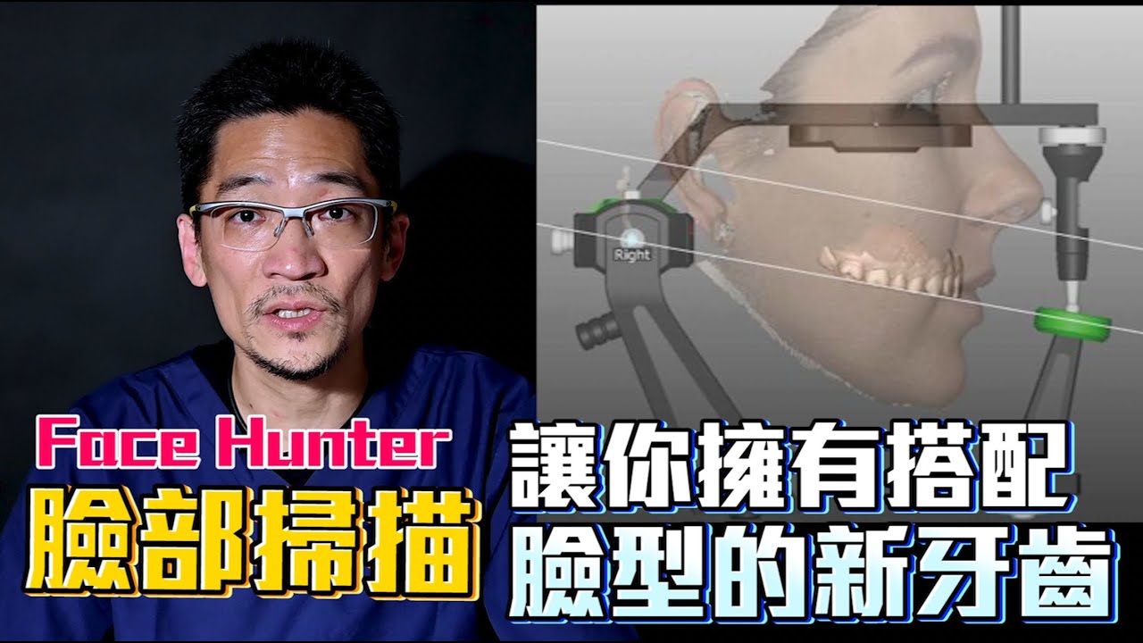 臉部掃描系統 讓你擁有搭配臉型的新牙齒！FACE HUNTER is the innovative new device by