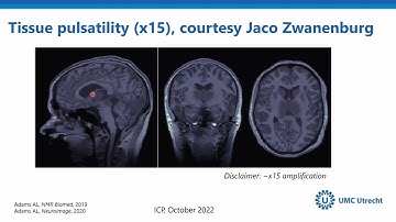 Non-invasive methods to image the brain clearance system