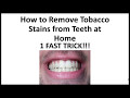 Can Tobacco Stains Be Removed From Teeth Can Tobacco Stains Be Removed From Teeth