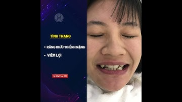 THAY ĐỔI NỤ CƯỜI - THAY ĐỔI CUỘC SỐNG NHỜ NIỀNG RĂNG!