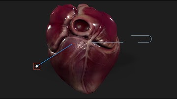 Hypervsn Kino-Mo 3D holographic visual content for the medical industry and education.