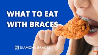 What To Eat With Braces