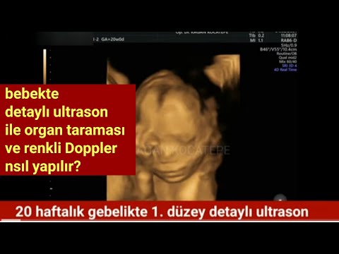 20. gebelik haftasında 1. düzey detaylı ultrason ile organ taraması ve renkli Doppler nasıl yapılır?