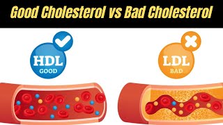 Good Cholesterol And Bad Cholesterol | LDL and HDL Cholesterol |Urdu/Hindi| Nutritionist Haris Anees