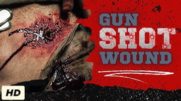 Gunshot Wound: Everything You Need To Know