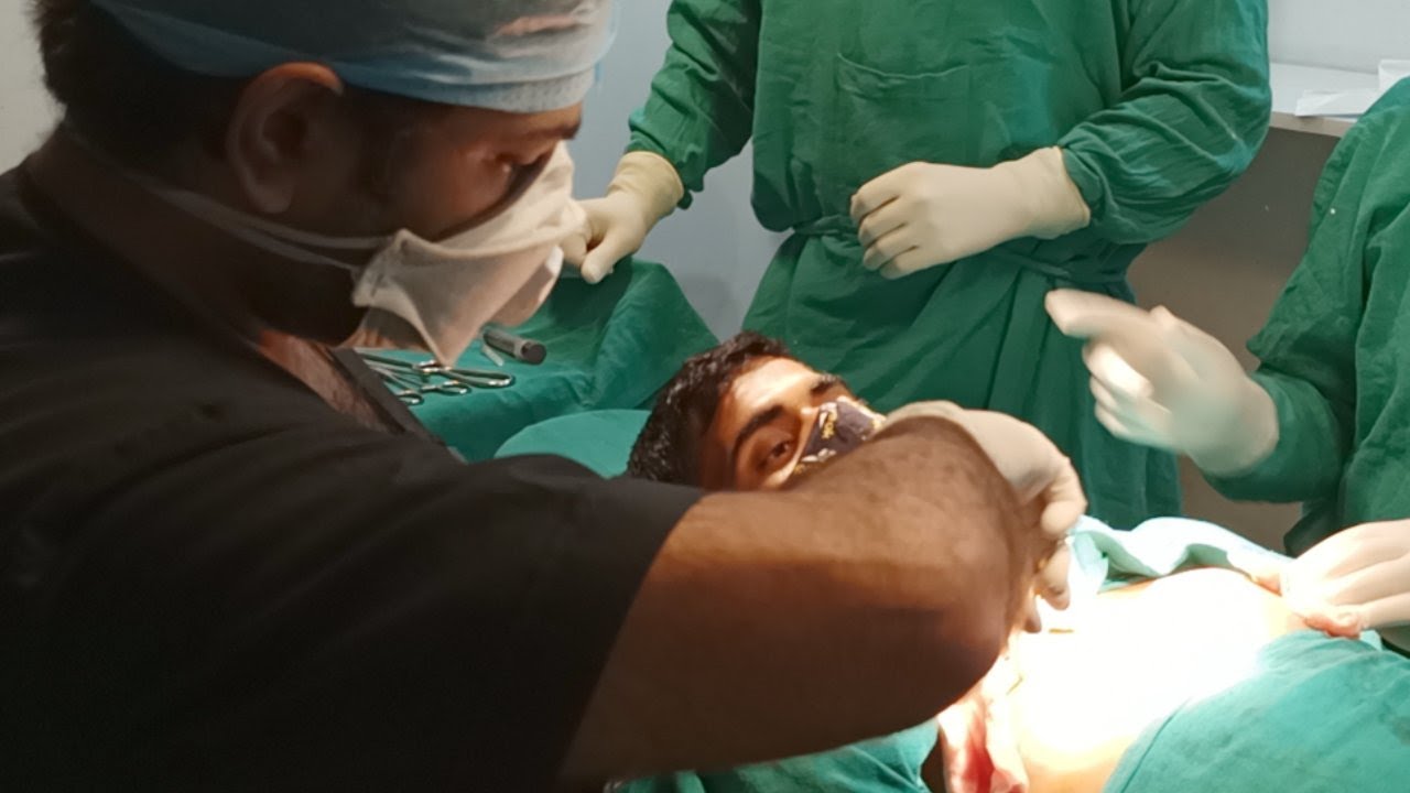 Gynecomastia Puffy Nipple Live Youtube