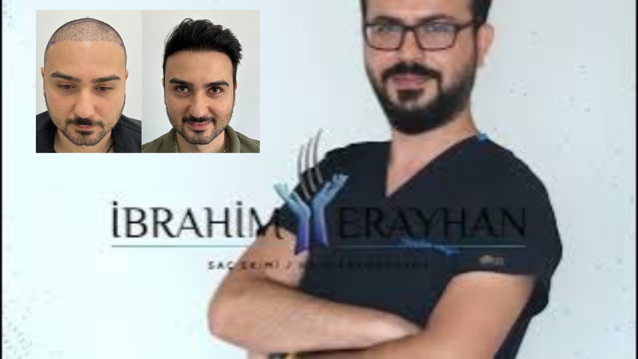 Doğal Olmayan Saç Ekiminde Ön Hat Düzeltilmesi - Frontline Correction In Unnatural Hair Transplant