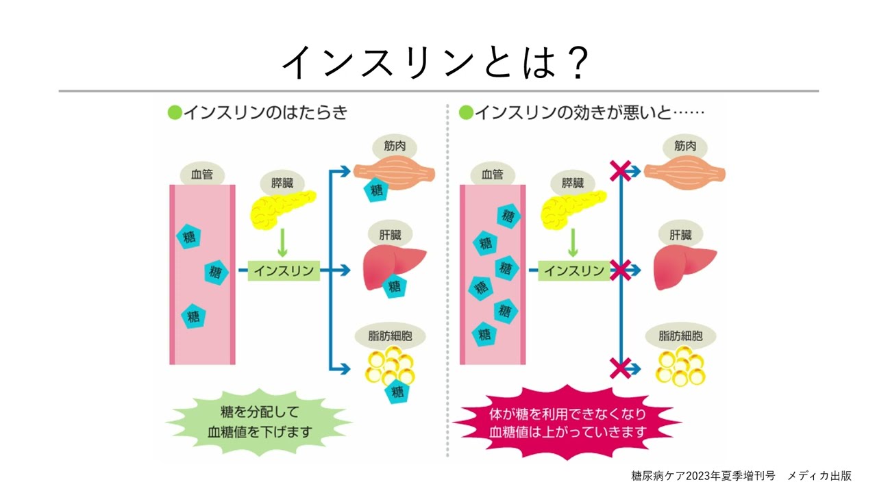 令和7年度 市民対象糖尿病教室 第1回「基礎からわかる糖尿病講座