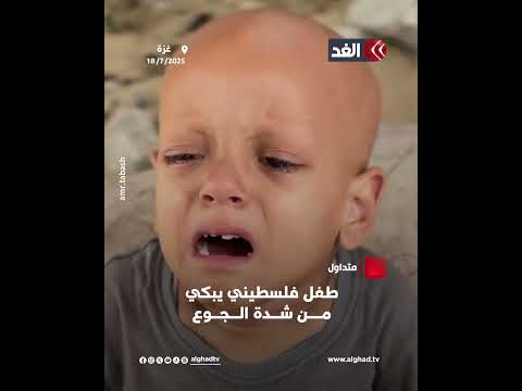 وسط نقص حاد للطعام وسوء التغذية مشهد مؤلم لطفل فلسطيني في قطاع غزة يبكي من شدة الجوع