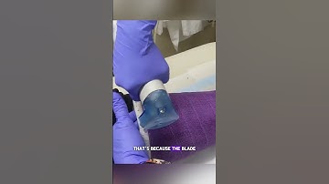 Why Cast Saws Don’t Cut Skin