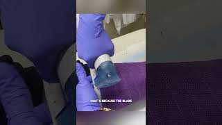 Why Cast Saws Don’t Cut Skin Profile
