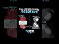 협심증 필수검사