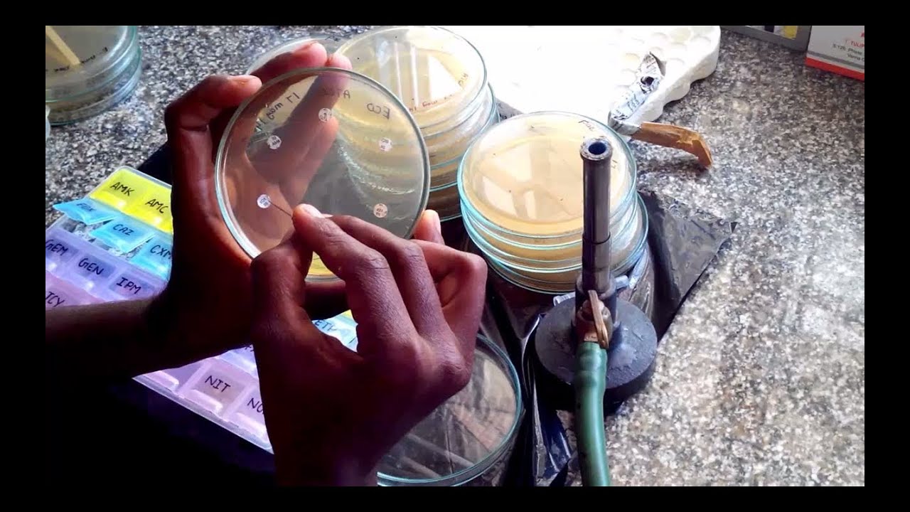 AST Kirby Bauer Disk Diffusion Method YouTube