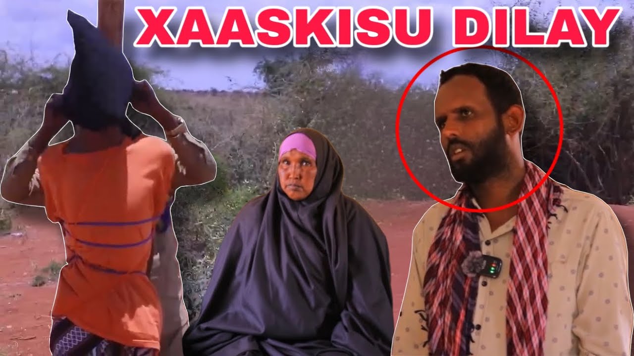 NINKI XAASKISA DILAY OO ISNA LAQABTAY WUXU KU HADLAY ILA DAAWO 7 XABAD AYU BEERKA UGALIYAY ILA EY KA