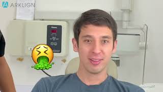 Full-mouth impression-taking technique Clip3