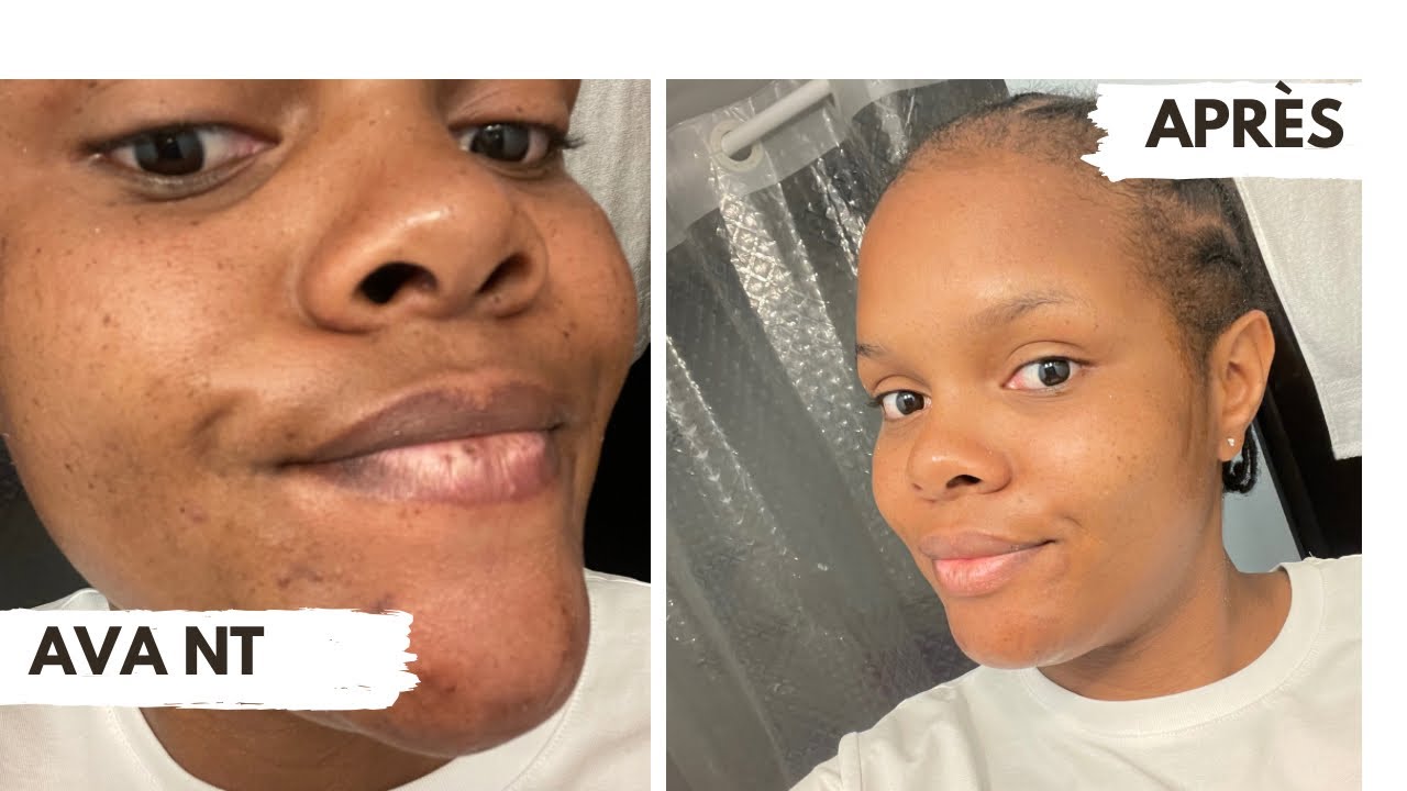 Comment avoir un beau teint: ma routine matinale - YouTube