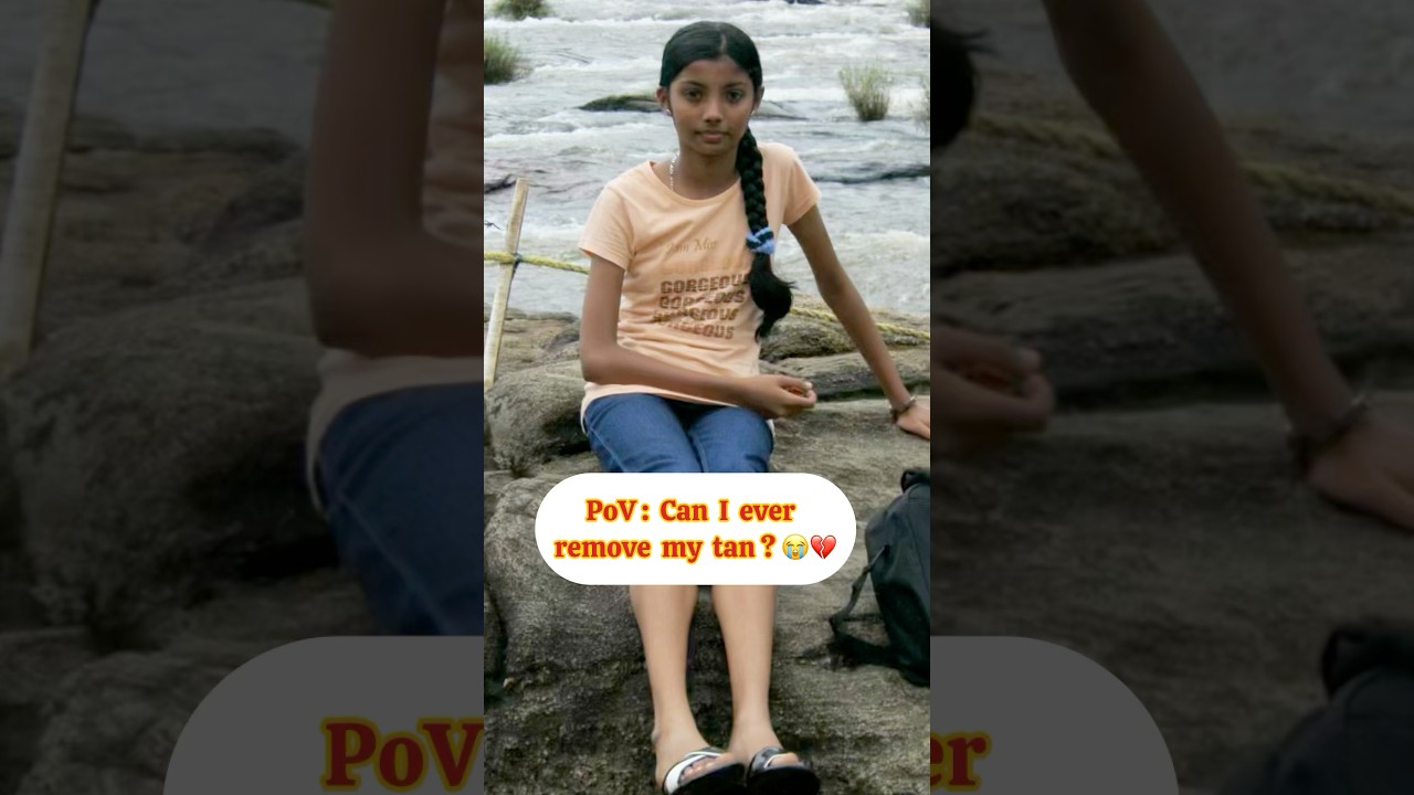 Obejrzyj 💔Childhood fulla hyperpigmentation dha😭 #tamil #skintransformation #suntan #skincare w YouTube Obejrzyj 💔Childhood fulla hyperpigmentation dha😭 #tamil #skintransformation #suntan #skincare w YouTube