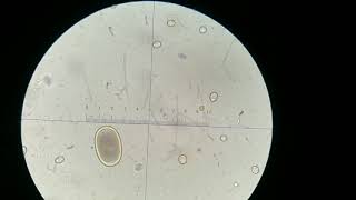 Eggs Ascaridia Galli Y Coccidia Oocysts