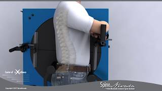 View spinal motion like a movie — Vertebral Motion Analysis (VMA) for Lumbar spine