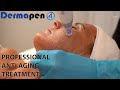Dermapen 4 professional antiaging facial treatment
