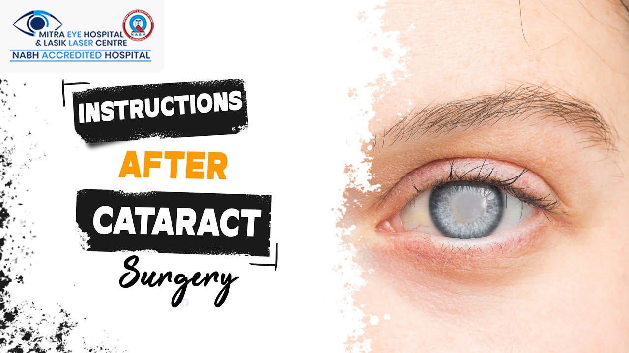 Instructions After Cataract Surgery | Best Eye Hospital in Punjab ...