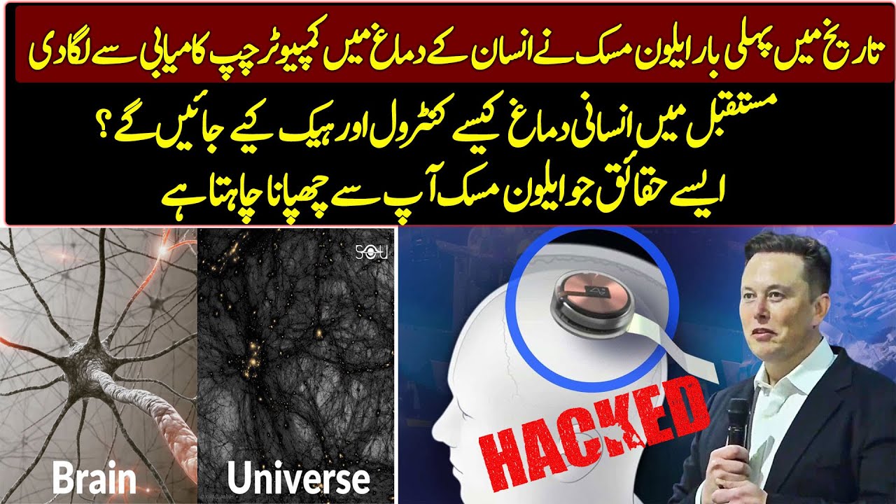 Unknown Facts About Elon Musk's Neuralink puts First Brain Chip in a Human !!