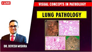 Visual concepts in Pathology: Lung Pathology by Dr Devesh Mishra