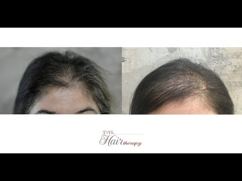 Testimonial Video |