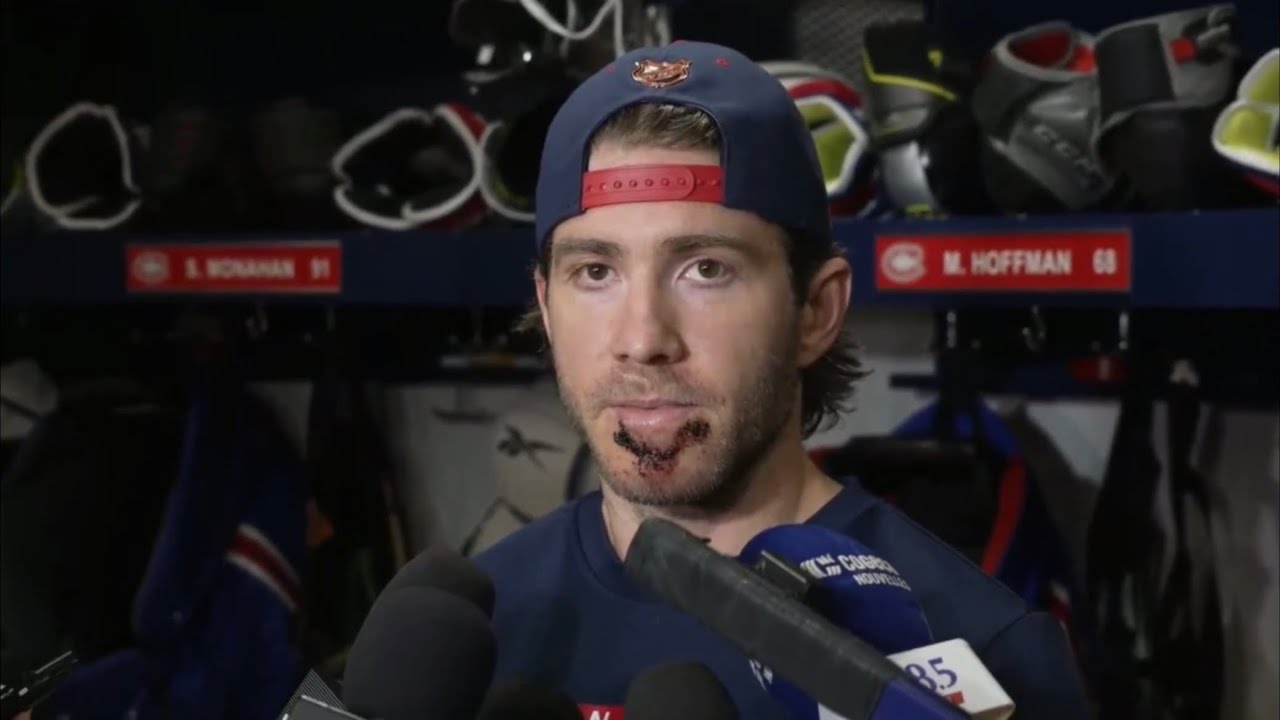 Canadiens' Mike Hoffman shows off gnarly scar after cross-check to the face