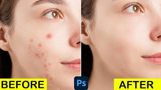 Face Retouching In Photoshop Made Easy Step By Step Photoshop Tutorial